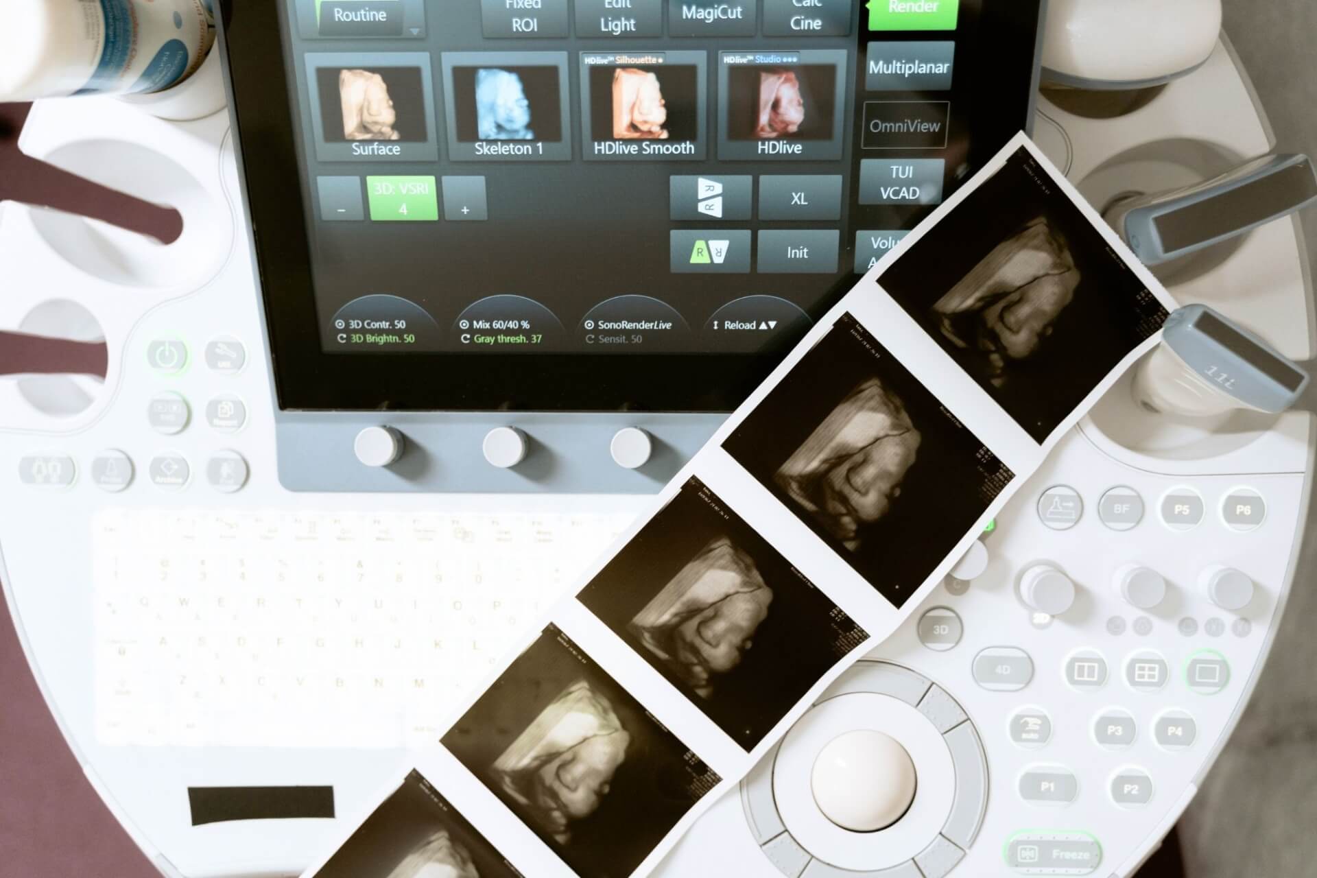 CGM TURBOMED für Frauenärzte: Das Facharztmodul Gynäkologie im Überblick